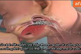 Lý giải về khả năng bú mẹ của trẻ sơ sinh Lý giải về khả năng bú mẹ của trẻ sơ sinh